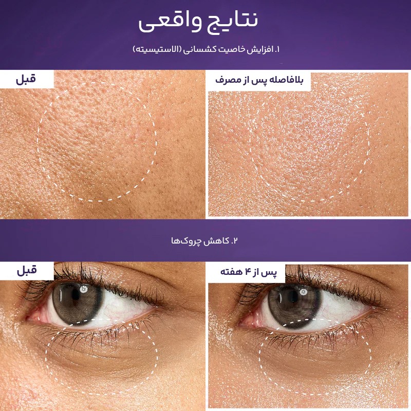 اسنس بایو لیفتینگ نامبر 9 نامبوزین