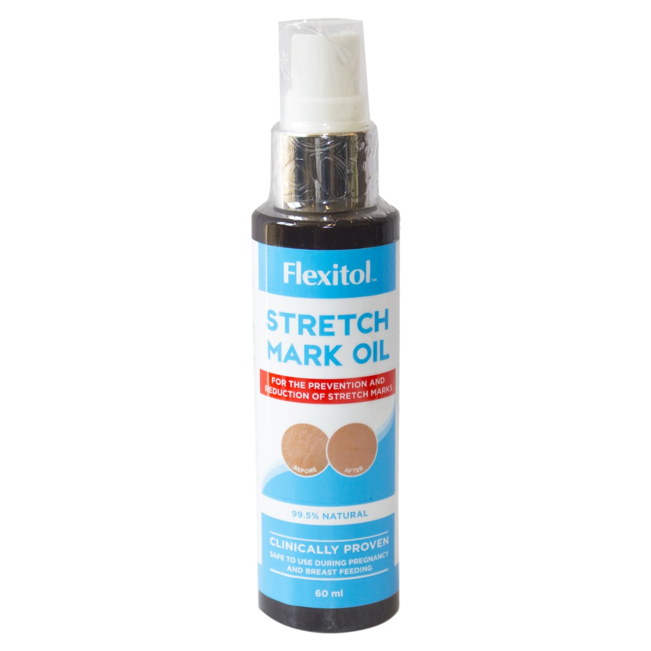 روغن رفع ترک پوست فلکسیتول مدل strech mark oil حجم 60 میلی لیتر